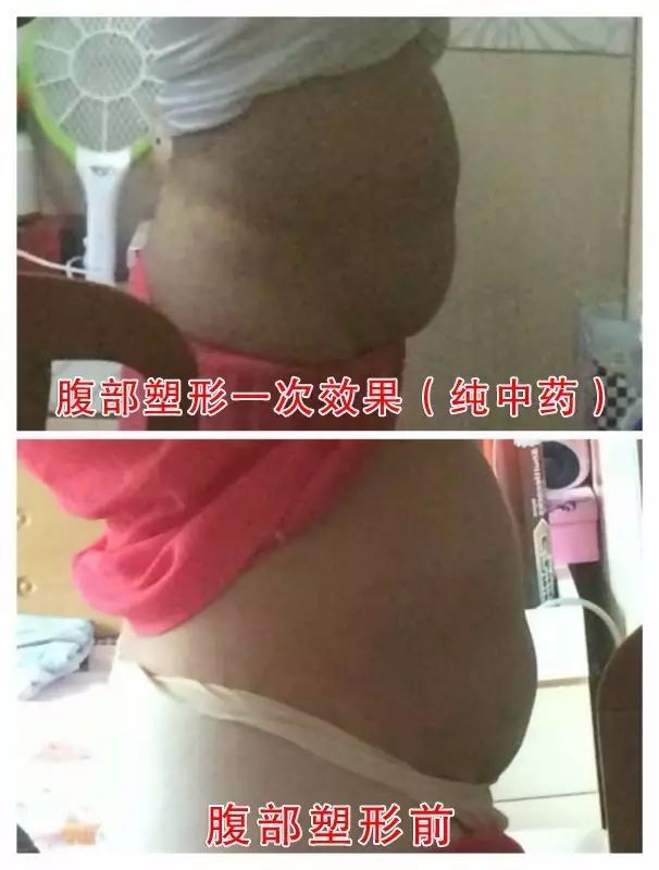b81e6124c1314dee0a84a8d31bb8c849.jpg