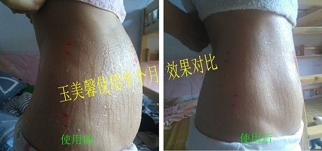 A4 使用半个月 效果对比2.jpg