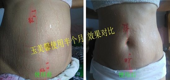 A3 使用半个月 效果对比 1.jpg